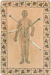 acupuncture2.jpg